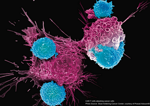 新car T细胞疗法有望用于晚期霍奇金淋巴瘤治疗 腾讯新闻