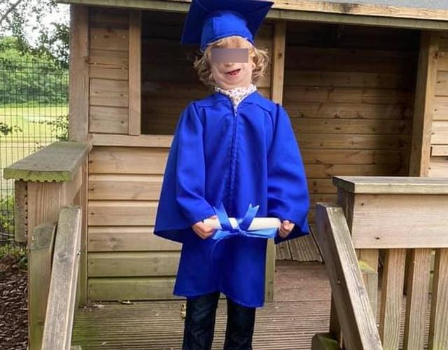 来自英国的4岁小男孩瑞恩·亨利·麦克林就患有鸟面综合症,又称特雷彻