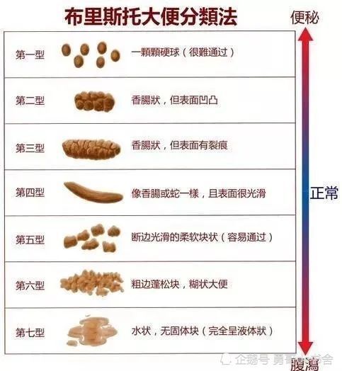 41岁装修工因大便变细被查出肠癌