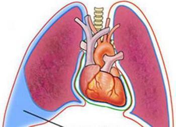 胸腔|胸腔积液量CT以及B超哪个准？