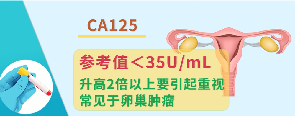 ca15-3(糖类抗原153):筛查妇科肿瘤常用的肿瘤标志物