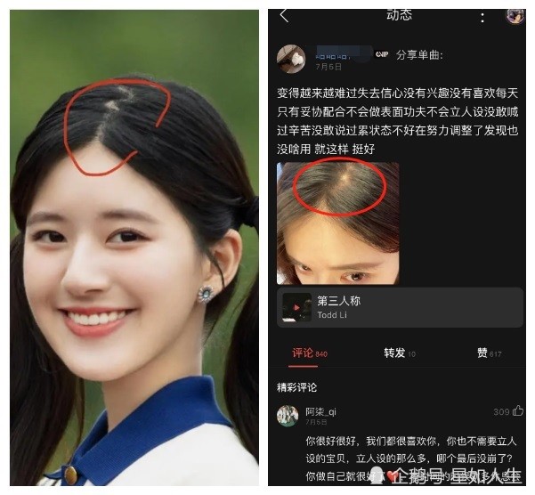 赵露思|已秃头？娱记曝赵露思曾多次挖鞠婧祎造型师，想学她发量造假套路