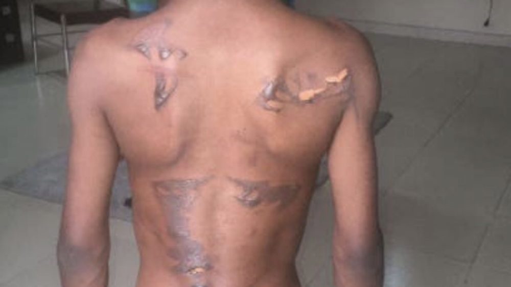 非洲_社会|非洲8岁男孩被姑姑用电熨斗烫得满身伤，只因偷吃了6毛钱的花生