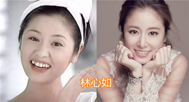 明星整牙前后的变化,胡歌,唐艺昕还好,看到baby:堪比整容了