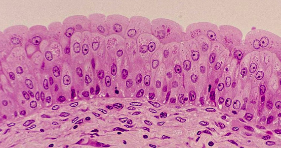 比如下面这张组织切片,我们不仅可以看到很多细胞,更能看到细胞外面
