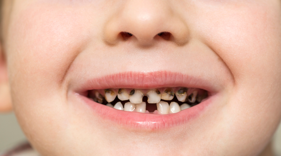 益生菌|常生病不是免疫力差！益生菌不治百病！101 条育儿谣言，一次全辟掉