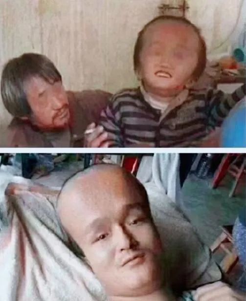 12年过去,那些喝三鹿奶粉长大的孩子,如今怎样了?看完让人泪目