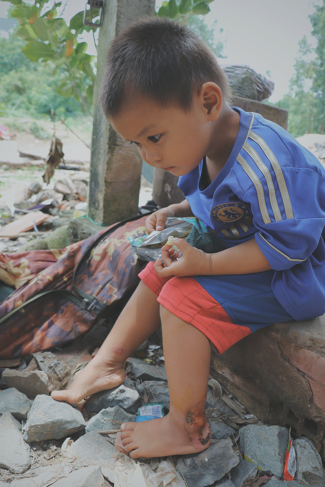孩子|女子缺乏避孕意识生了4个娃，如今男友患病卧床孩子们温饱成问题