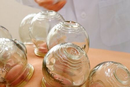 拔罐后不同印记代表什么你拔罐后出现什么颜色的印记