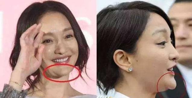 baby杨幂|杨紫惊现“饺子下巴”，遭质疑又变脸，baby杨幂其实都有同款