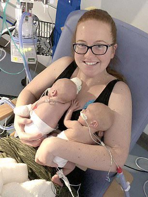 孕妇|怀双胞胎的孕妇早产生下第一个孩子，间隔两天二儿子才出生