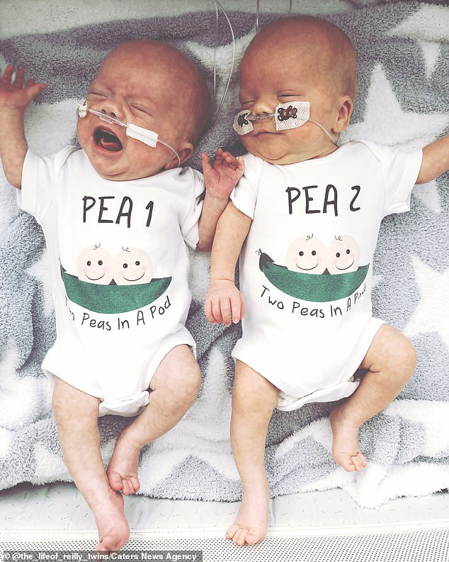 孕妇|怀双胞胎的孕妇早产生下第一个孩子，间隔两天二儿子才出生