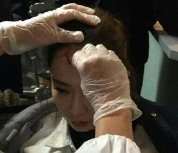 戚薇|“容易受伤的女人”戚薇又摔伤，下飞机直接送院，坐轮椅画面曝光