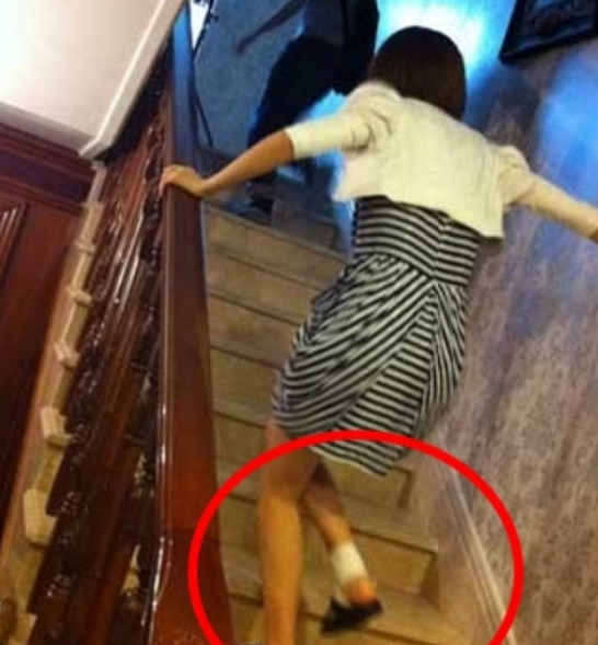 戚薇|“容易受伤的女人”戚薇又摔伤，下飞机直接送院，坐轮椅画面曝光