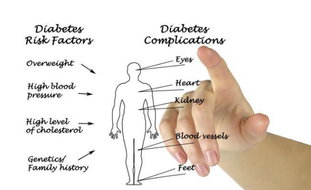 糖尿病并发症|糖尿病坚持吃药了，为何还是发生并发症，这3点值得格外注意