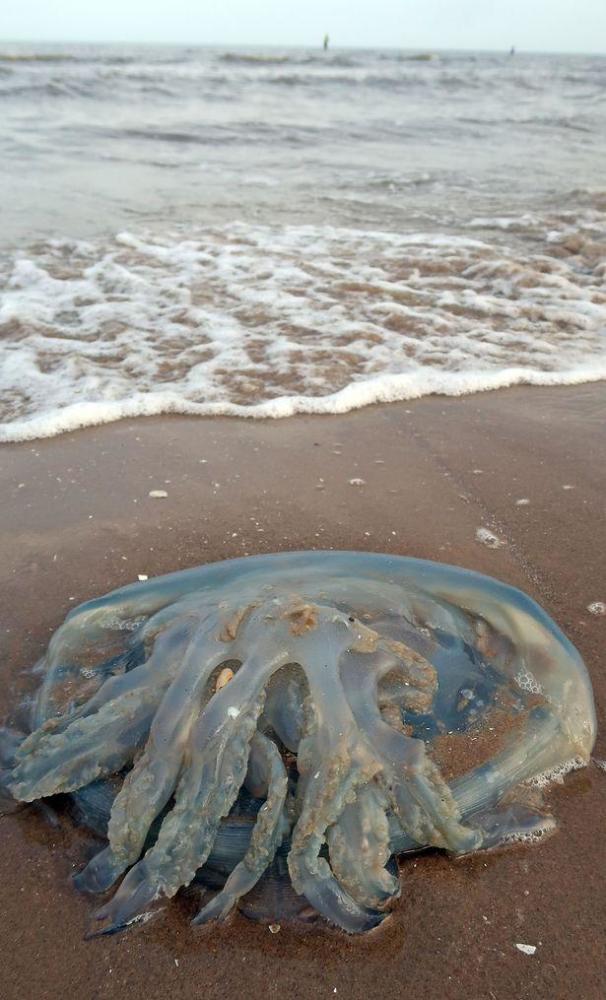 英国一母亲被水母蜇伤称比生孩子还痛