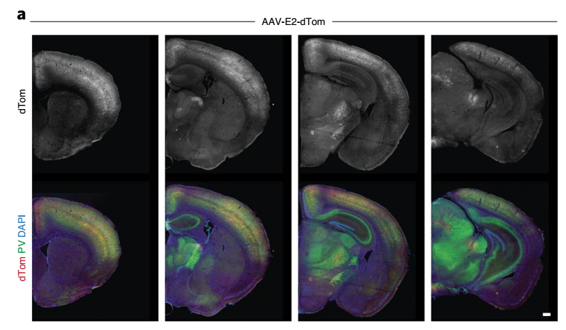 神经元|【Nature子刊】“恶棍”基因或成为操纵中间能神经元的有力工具