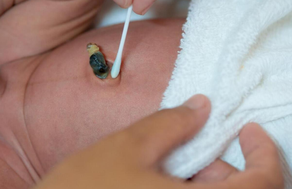 剪脐带和脐带血知识妈妈知道吗,存脐带血,到底是不是智商税