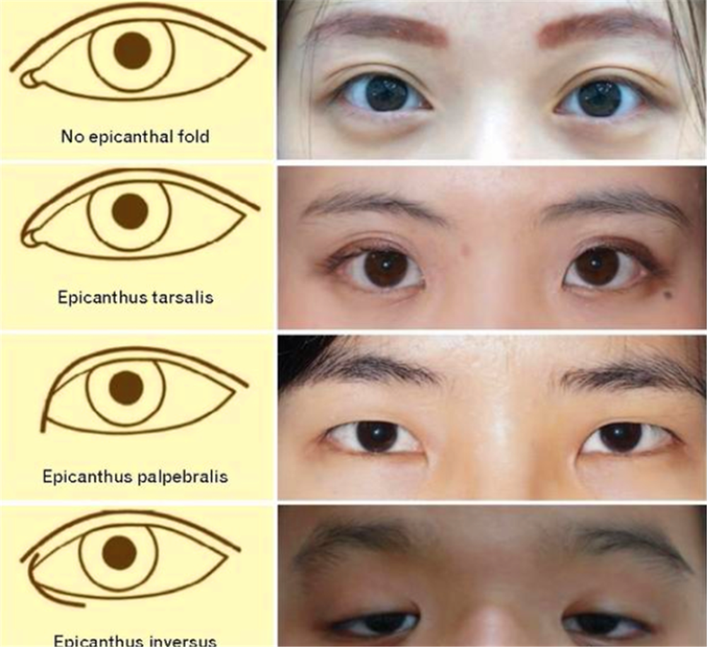 中国人的双眼皮基因是从哪个民族输入的