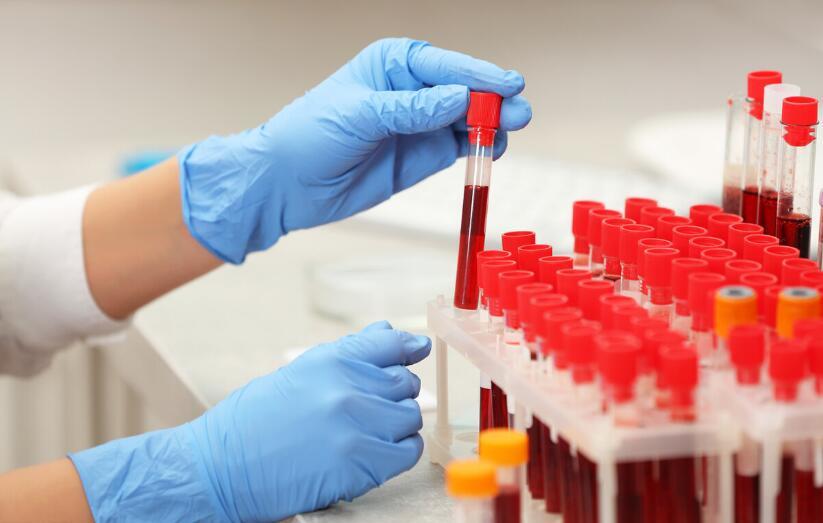 肾功能|4项指标了解肾功能，浅显易懂，越早知道越有利于防肾衰竭