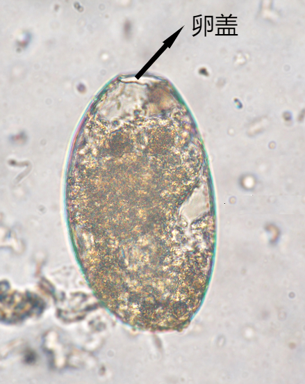 布氏姜片吸虫卵3纺锤形,大小约50um×20um,卵壳较厚,虫卵两端均有透明