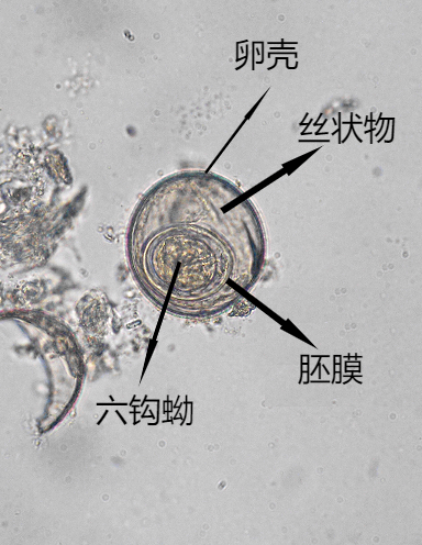 微小短壳膜绦虫卵图片