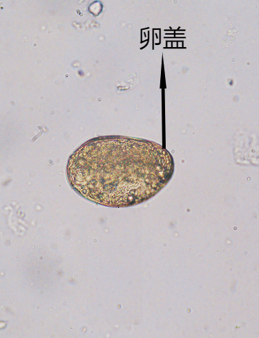 肺吸虫卵6呈球形,大小约50um×40um,卵壳很薄,胚膜较厚,胚膜两端略