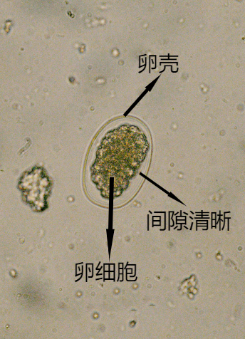 室间质评中常见寄生虫卵及鉴别要点