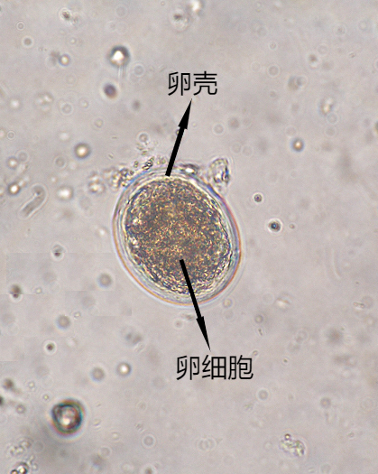 受精蛔蟲卵11蟯蟲卵10未受精蛔蟲卵09日本血吸蟲卵8鉤蟲卵7肝吸蟲卵06