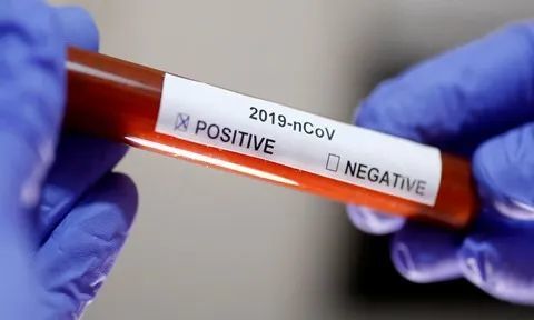 疫苗|新加坡惊现新冠病毒变异体！卫生部：医护人员和弱势病人将优先注射疫苗