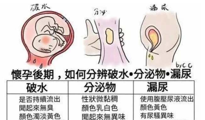 孕晚期咳嗽感觉有东西流出来会是羊水吗大多与这个原因有关