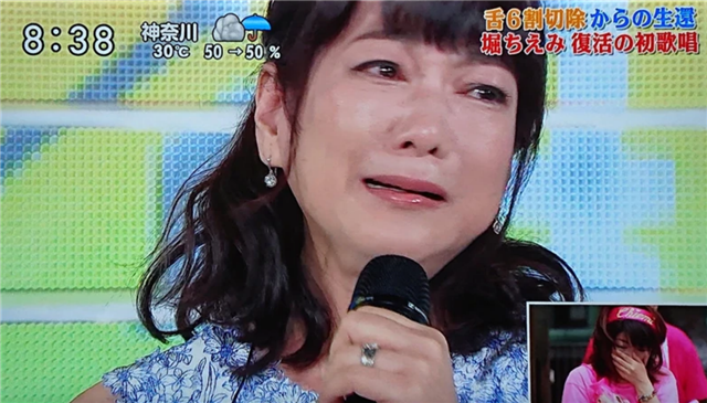 复出|女星口腔癌后又患食道癌，复出唱歌在舞台上掩面痛哭