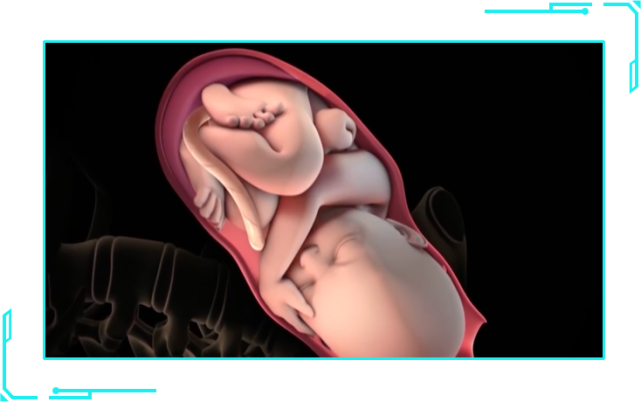 子宫内膜异位症|不孕不育|卵子|受孕