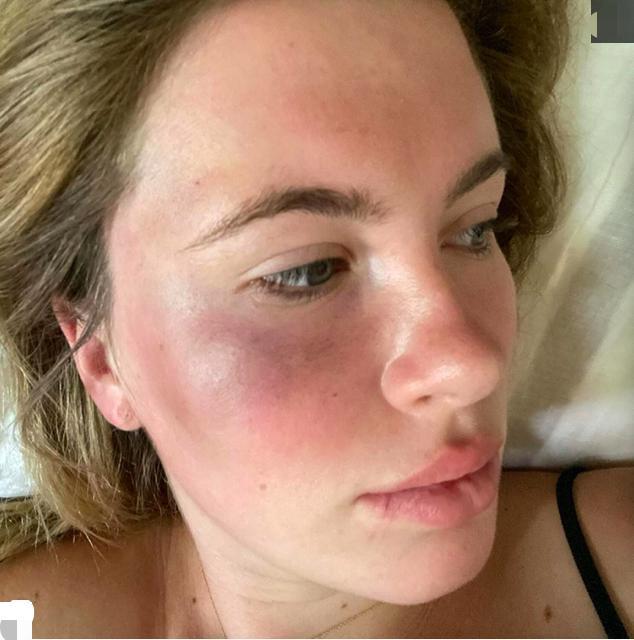 24岁超模在停车场遭袭击面部被打淤青明显钱财也被洗劫一空