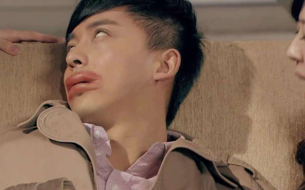 萌娃吃葡萄过敏嘴巴肿成"香肠嘴",爸爸大笑,表示不但性感还酷