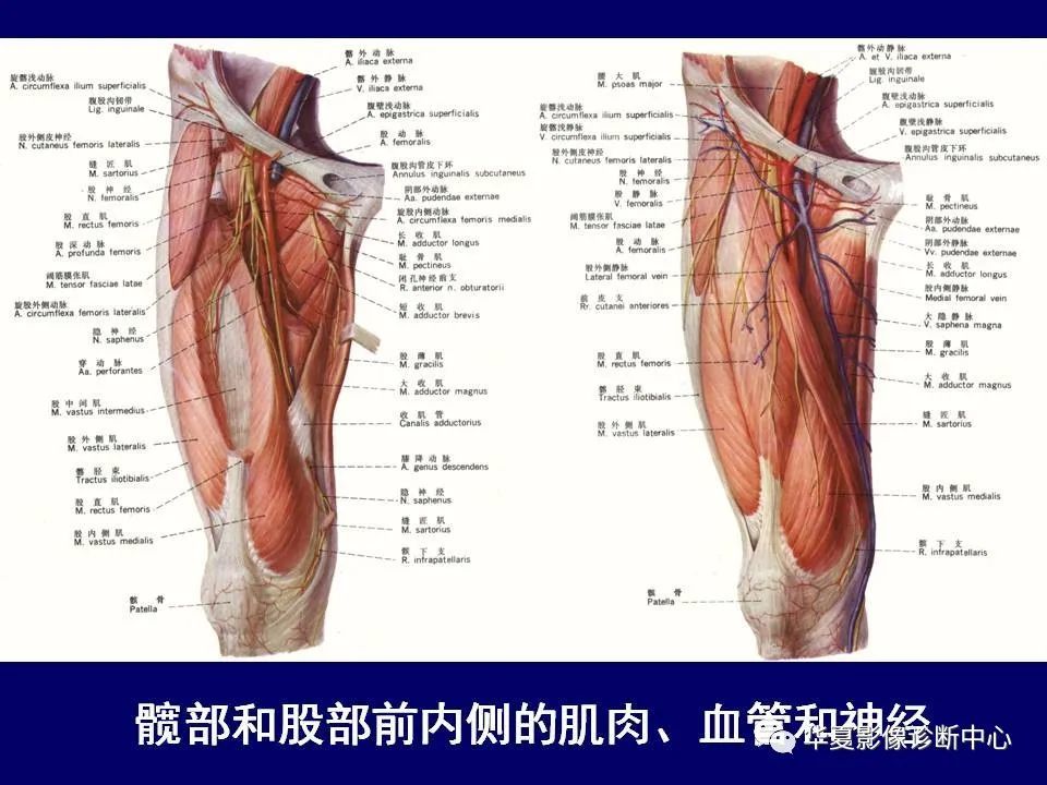 大腿肌肉核磁解剖图片
