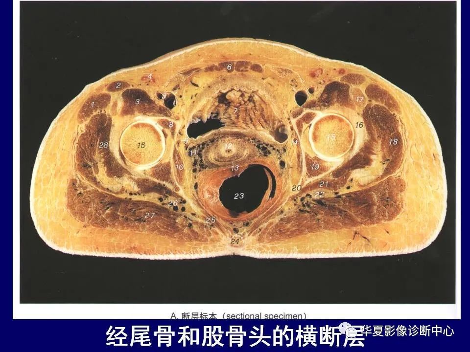 最全的下肢mri解剖
