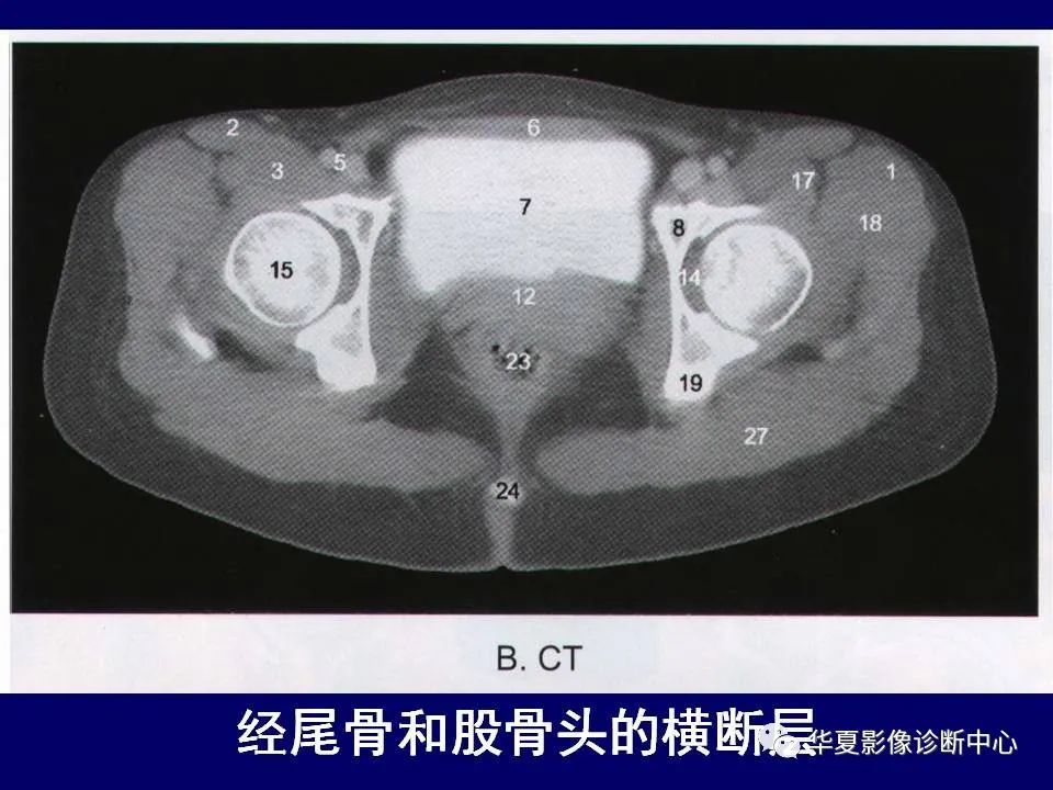 最全的下肢mri解剖
