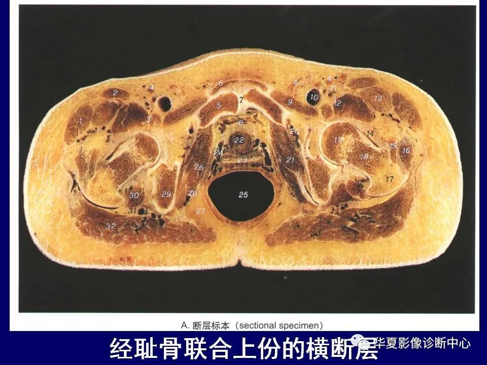 最全的下肢mri解剖