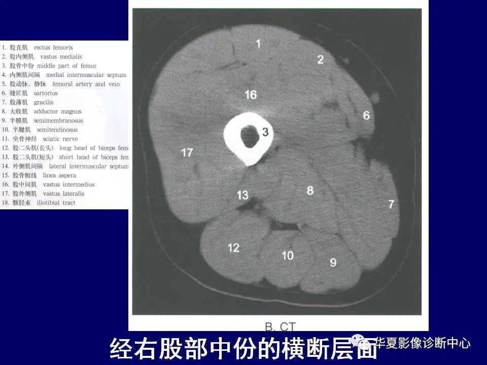 最全的下肢mri解剖