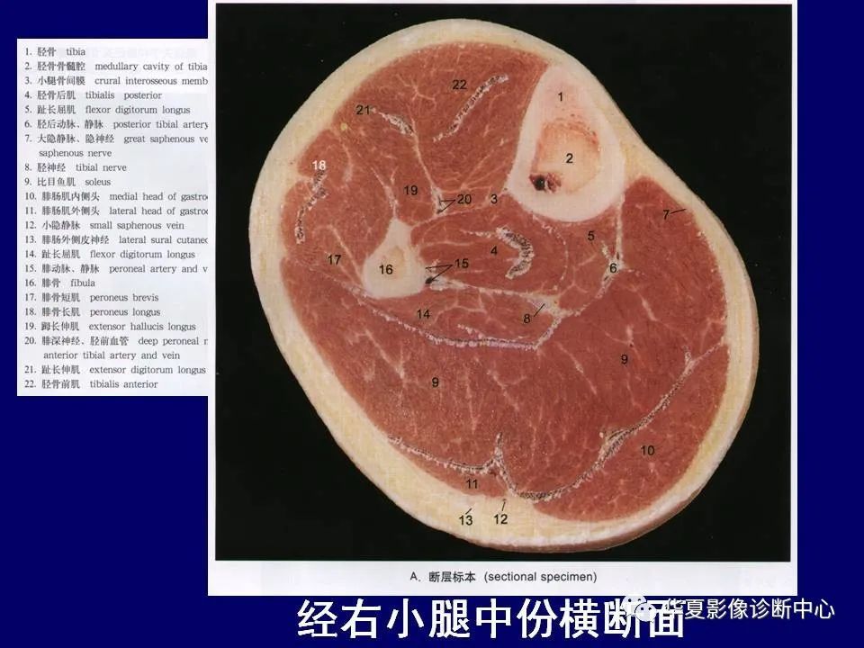最全的下肢mri解剖