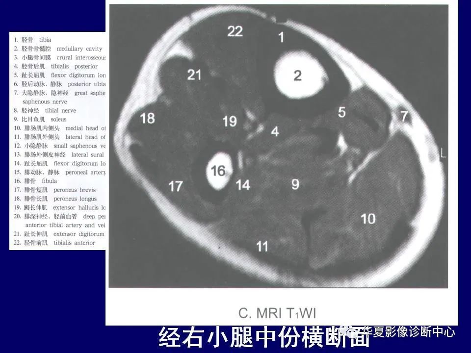 最全的下肢mri解剖