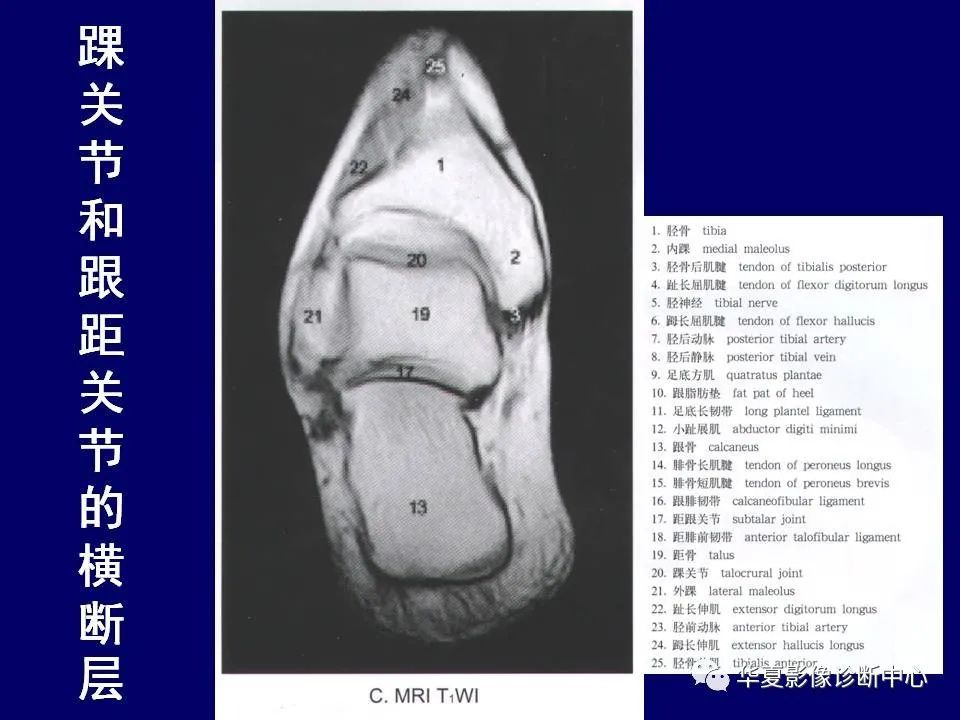 最全的下肢mri解剖
