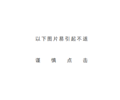 费尔南达·马丁内斯|脖子皮肤能遮脸，反手摸肚脐，手指掰成180°——TA们都是病人