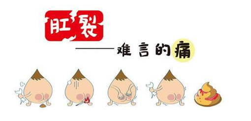 合喻昌:肛裂症状的四个阶段,看一下自己在什么阶段
