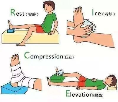 四,elevate-抬高患肢三,compression-加压包扎二,ice-冰敷一,rest