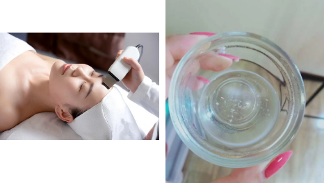 小气泡清洁常用的管理方式