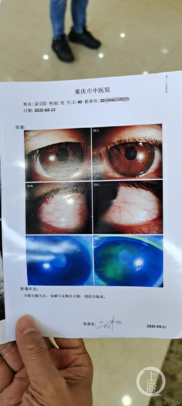 烧烤店撸串的小心了这家店用紫外线灯消毒致4人眼睛灼伤