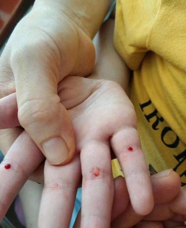 求孩子的心理阴影面积.