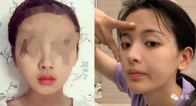 杨超越|杨超越5年前生图爆出，腋下这是怎么了…